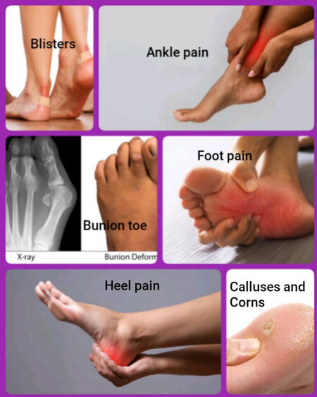 Some pains and feet malformations that can result from constant wearing of heels without cushioning